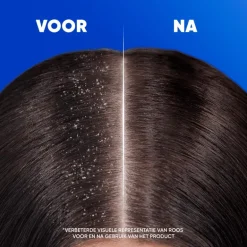 Head & Shoulders Citrus Fresh Anti-roos Shampoo 625 ML