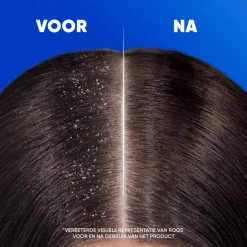 Head & Shoulders Citrus Fresh Anti-Roos Shampoo 300 ML