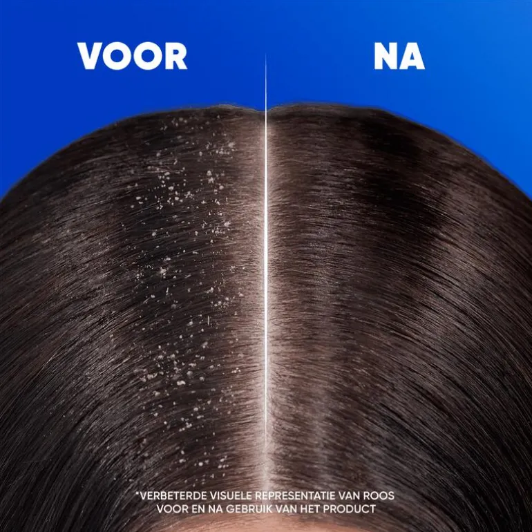 Head & Shoulders Citrus Fresh Anti-Roos Shampoo 300 ML