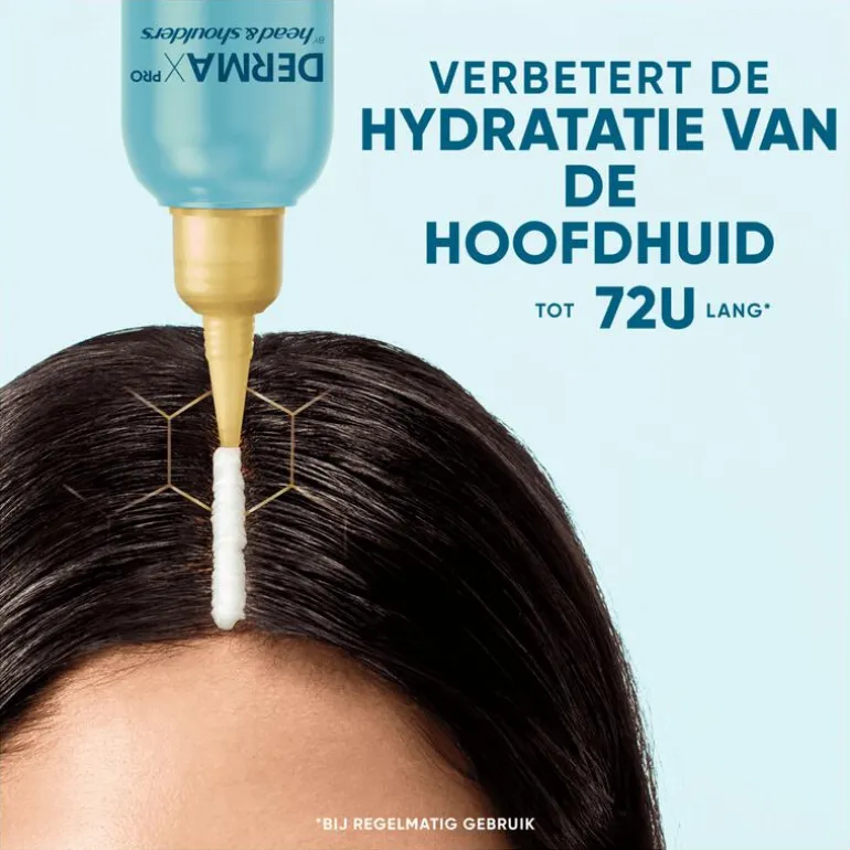 Head & Shoulders Derma X Pro Kalmeert Hoofdhuidbalsem Anti-roos 145 ML