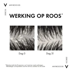 Vichy Dercos Anti-Roos Shampoo Droog Haar 390 ML