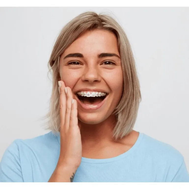 VITIS Orthodontic Mondspoeling